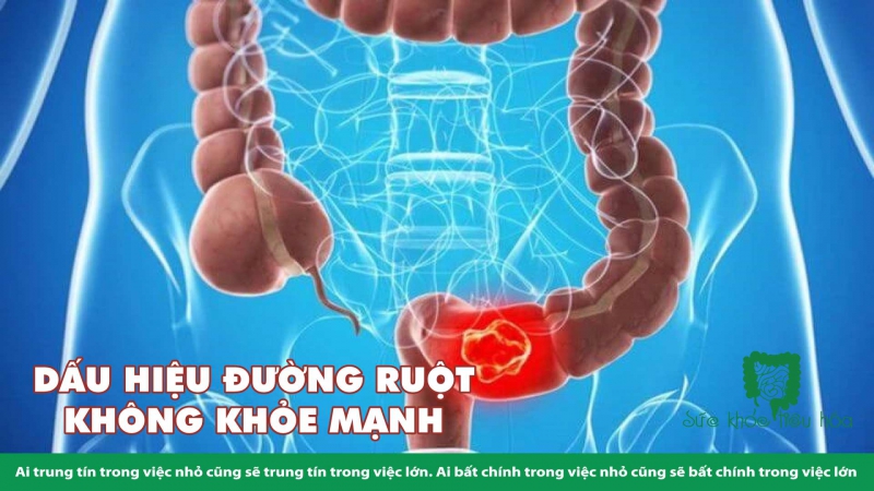 CHĂM SÓC SỨC KHỎE TIÊU HÓA