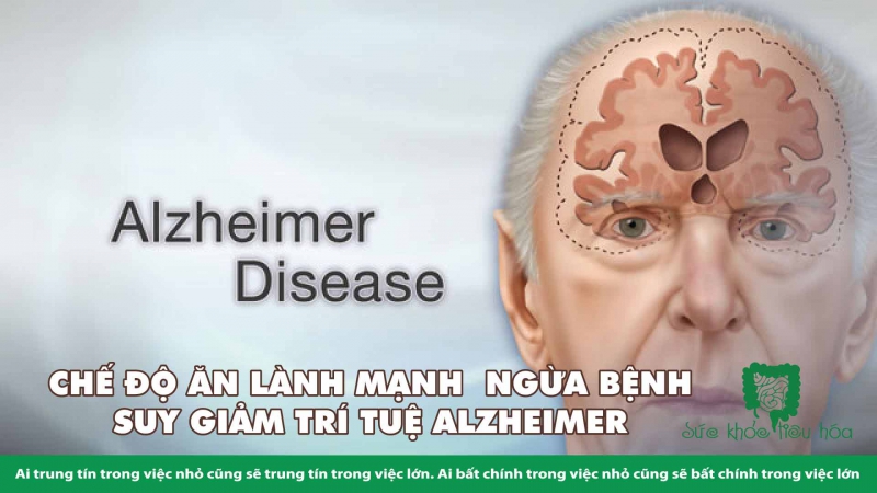 CHẾ ĐỘ ĂN LÀNH MẠNH  NGỪA BỆNH  SUY GIẢM TRÍ TUỆ ALZHEIMER 