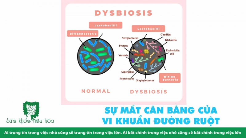 LIÊN HỆ  DỊ ỨNG THỰC PHẨM & SỨC KHỎE ĐƯỜNG RUỘT