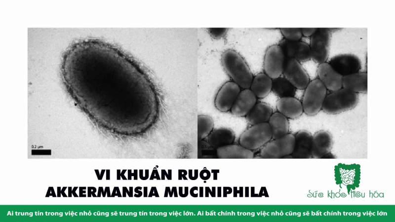 AKKERMANSIA MUCINIPHILA: MỘT VI KHUẨN QUAN TRỌNG TRONG HỆ VI SINH RUỘT HỖ TRỢ SỨC KHỎE TỐT