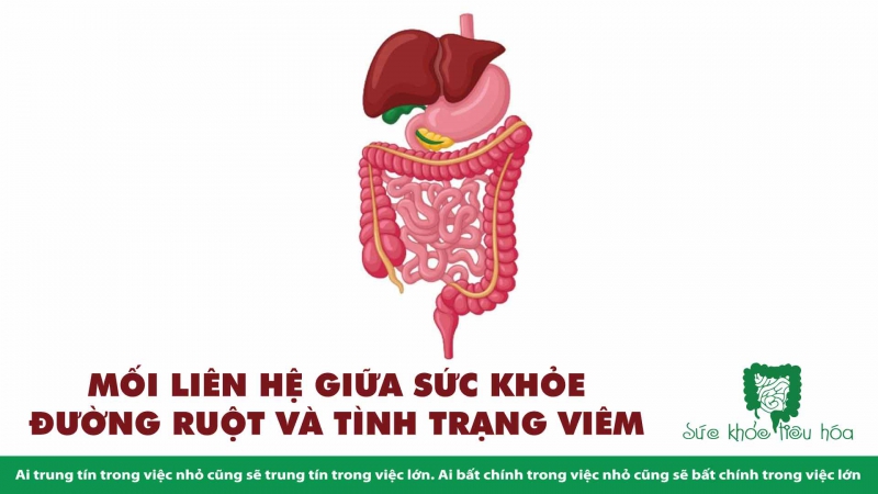 PROBIOTICS KHÁNG VIÊM HIỆU QUẢ TRONG CÁC BỆNH VIÊM RUỘT MÃN TÍNH 