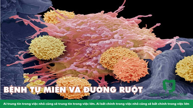 LIÊN HỆ GIỮA BỆNH TỰ MIỄN & HỆ VI SINH RUỘT