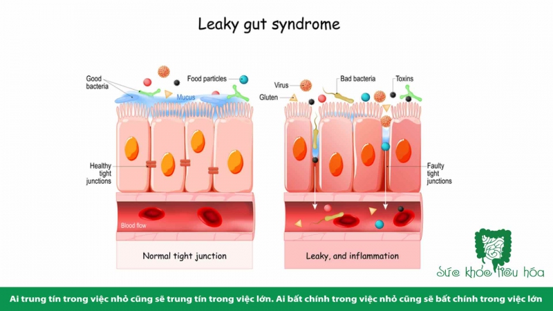 RỐI LOẠN SINH LÝ ĐƯỜNG RUỘT