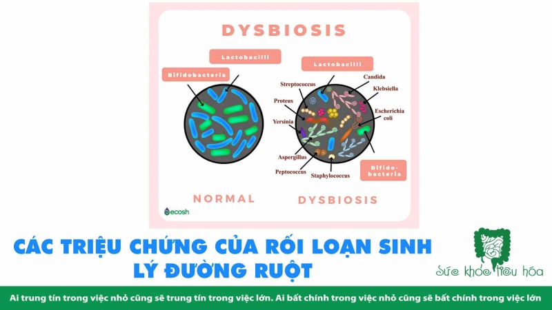 RỐI LOẠN SINH LÝ ĐƯỜNG RUỘT