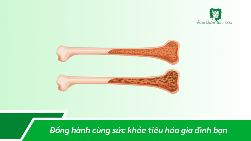 TĂNG CHIỀU CAO NHỜ SỮA NON CHUẨN HÓA