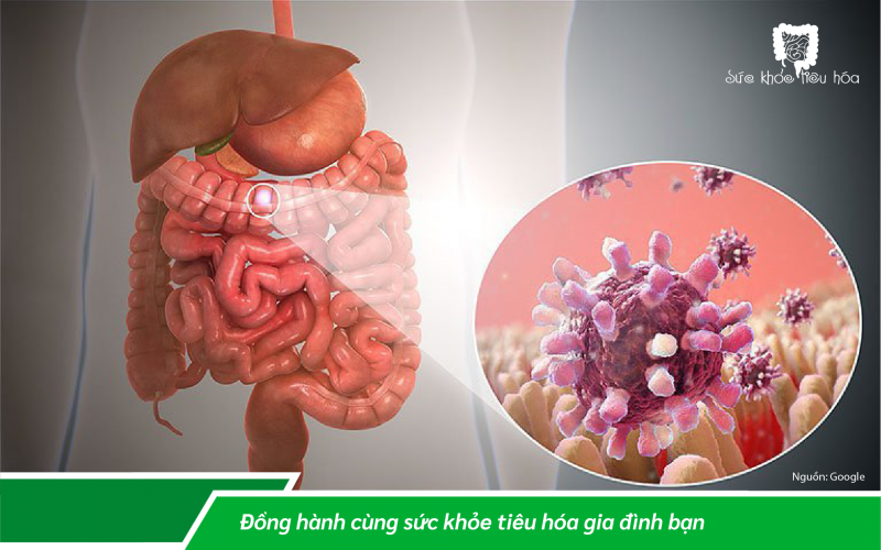 ĐÁNH MẤT HỆ VI SINH – CHÚNG TA CÓ THỂ ĐÃ MẤT MỘT ĐỒNG MINH RẤT XƯA NHƯ THẾ NÀO!