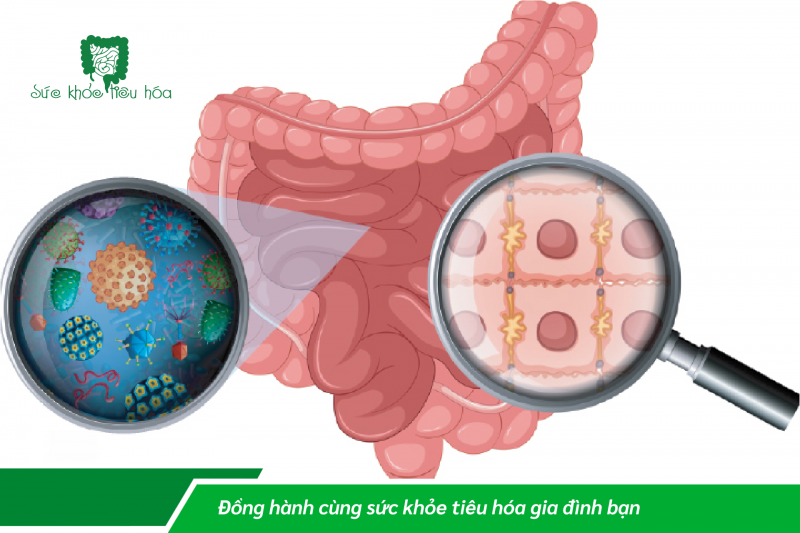 ĐƯỜNG RUỘT “NHẠY CẢM”