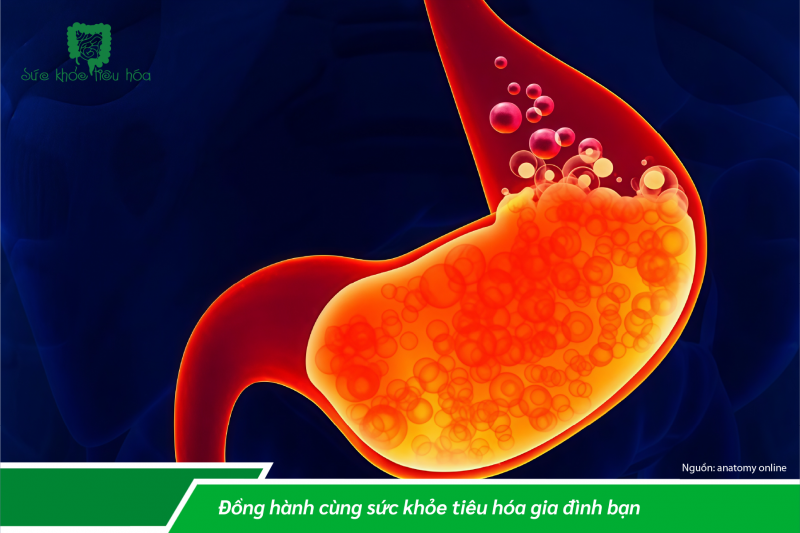 Ợ NÓNG, Ợ CHUA LÀ BỆNH GÌ?