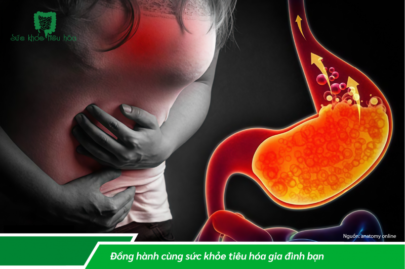 Ợ NÓNG, Ợ CHUA LÀ BỆNH GÌ?
