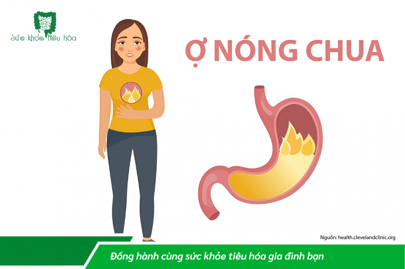 Ợ NÓNG, Ợ CHUA LÀ BỆNH GÌ?