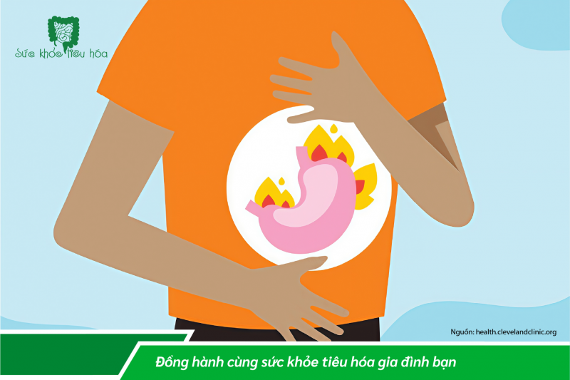 Ợ NÓNG, Ợ CHUA LÀ BỆNH GÌ?