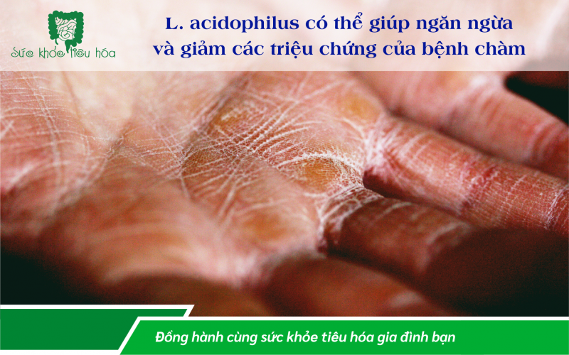 9 LỢI ÍCH CHO SỨC KHỎE CỦA LACTOBACILLUS ACIDOPHILUS