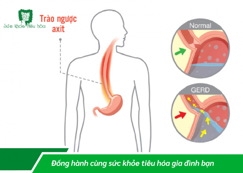 HỆ TIÊU HÓA “BỘ NÃO THỨ HAI” CỦA CƠ THỂ CON NGƯỜI
