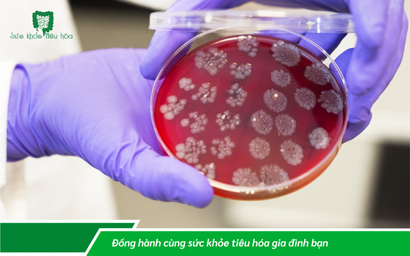 HỆ VI SINH CẢI THIỆN SỨC KHỎE BẠN NHƯ THẾ NÀO?