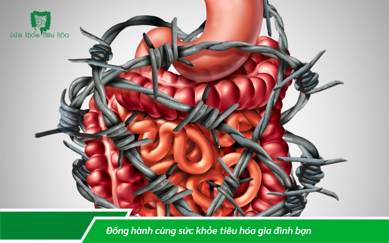 KIẾN THỨC THÔNG THƯỜNG CẦN BIẾT VỀ HỘI CHỨNG RUỘT KÍCH THÍCH!