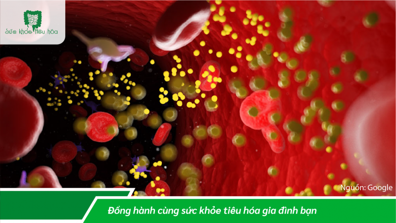 LỢI ÍCH GIẢM CHOLESTEROL MÁU CỦA MEN GẠO ĐỎ