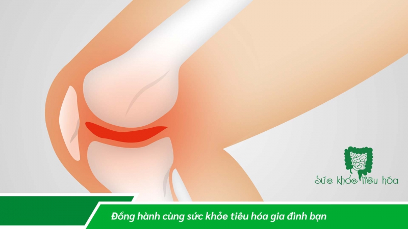 LỢI ÍCH CỦA LACTOBACILLUS PLANTARUM ĐỐI VỚI SỨC KHỎE