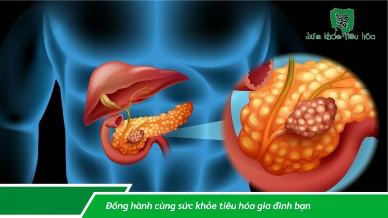 MEN TIÊU HÓA NGUỒN THỰC VẬT BẢO ĐẢM TỐT CHO TIÊU HÓA