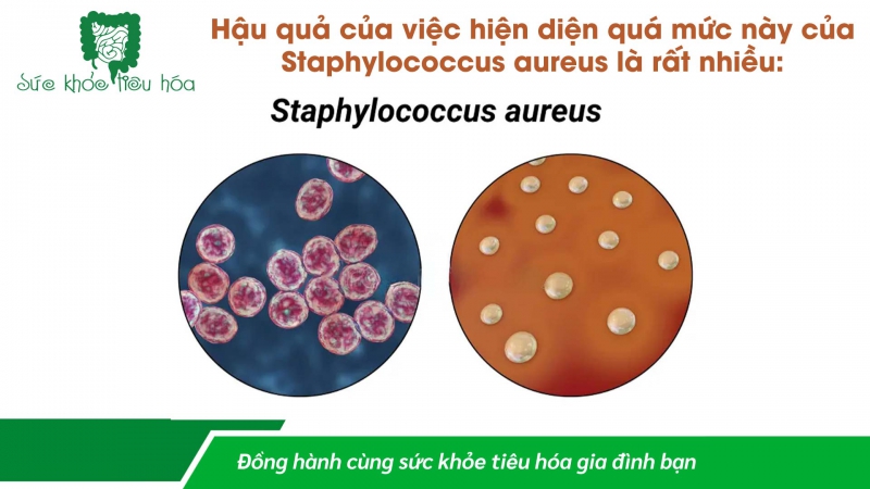 MEN VI SINH PROBIOTICS ĐIỀU TRỊ BỆNH CHÀM DA ECZEMA Ở BÀ MẸ & TRẺ EM