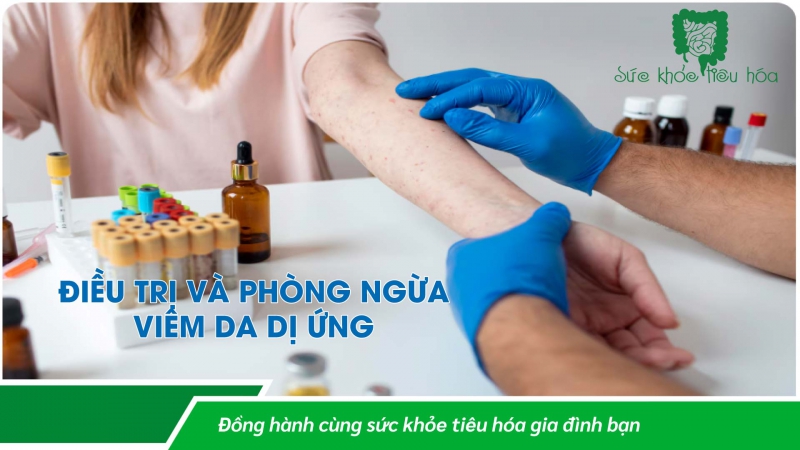 MEN VI SINH PROBIOTICS ĐIỀU TRỊ BỆNH CHÀM DA ECZEMA Ở BÀ MẸ & TRẺ EM