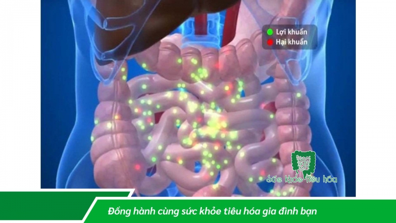 STRESS VÀ RỐI LOẠN TIÊU HÓA