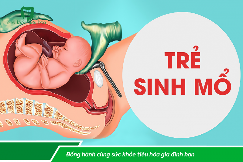 TRẺ SINH NON, SINH MỔ CÓ SỨC KHỎE ĐƯỜNG RUỘT YẾU