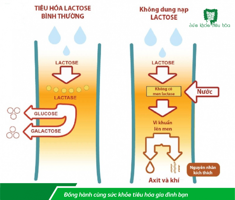 TRẺ TIÊU CHẢY DO BẤT DUNG NẠP LACTOSE