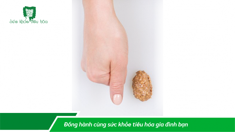 CHẾ ĐỘ ĂN HỢP LÝ THEO NGUYÊN TẮC BÀN TAY