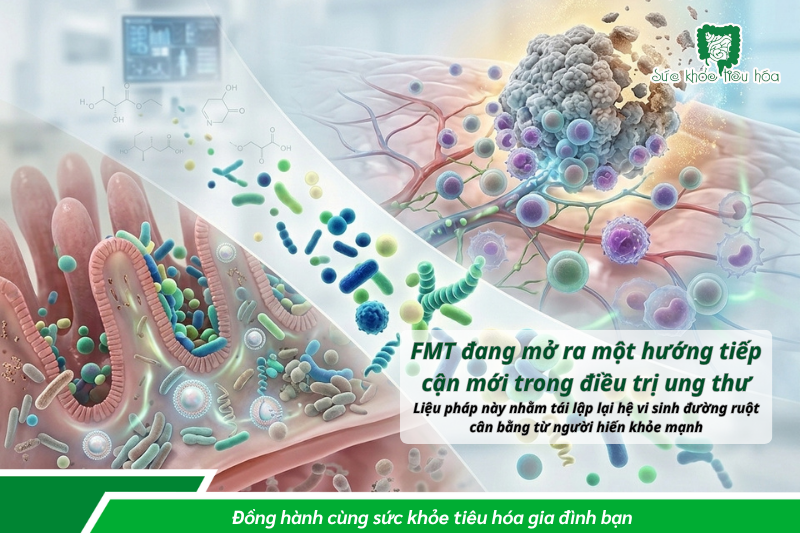 HÀNG NGHÌN TỶ VI KHUẨN TRONG RUỘT BẠN ĐANG GÓP PHẦN GIẢM NGUY CƠ UNG THƯ?